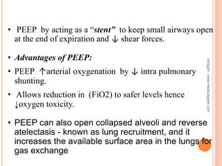 ARDS - Diagnosis and Management | PPTX