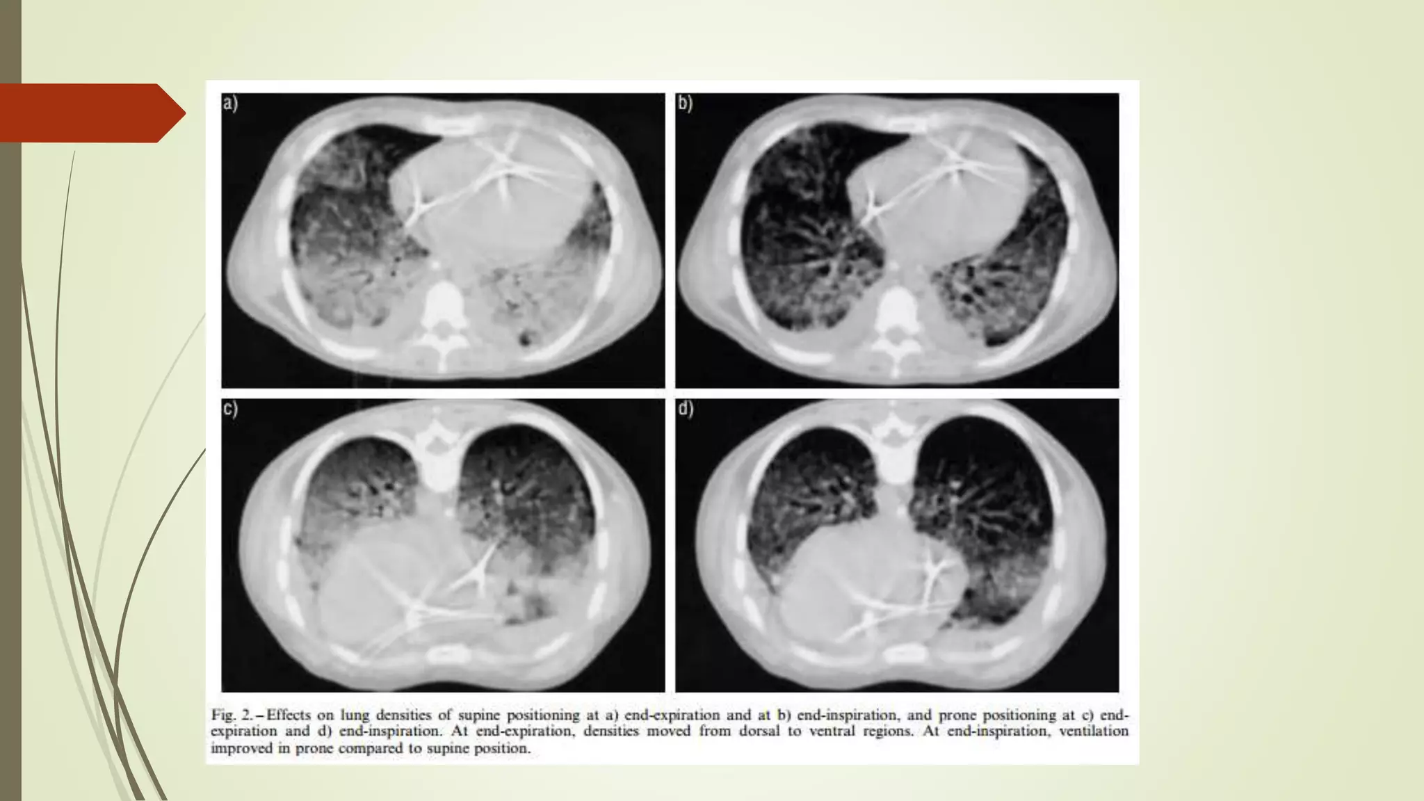 Children's Specialized Hospital Outpatient Center – Union visual data 8