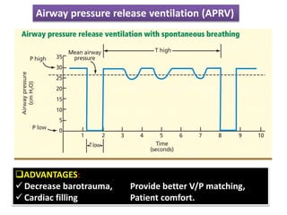 ADVANTAGES:
 Decrease barotrauma, Provide better V/P matching,
 Cardiac filling Patient comfort.
Airway pressure release ventilation (APRV)
 