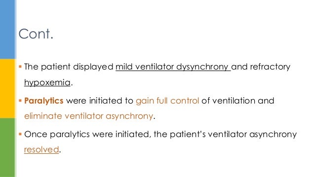 Ards case study examples image