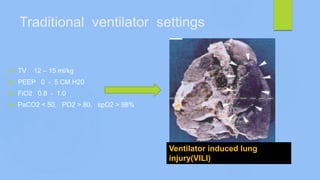 Traditional ventilator settings
 TV 12 – 15 ml/kg
 PEEP 0 - 5 CM H20
 FiO2 0.8 - 1.0
 PaCO2 < 50, PO2 > 80, spO2 > 98%
Ventilator induced lung
injury(VILI)
 