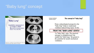 “Baby lung” concept
 