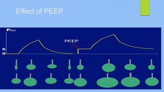 Effect of PEEP
 