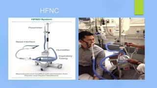 HFNC
 