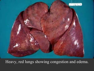 Heavy, red lungs showing congestion and edema. 
