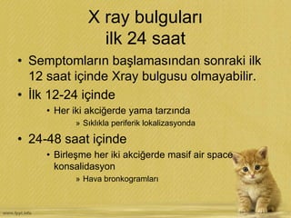 X ray bulguları
ilk 24 saat
• Semptomların başlamasından sonraki ilk
12 saat içinde Xray bulgusu olmayabilir.
• İlk 12-24 içinde
• Her iki akciğerde yama tarzında
» Sıklıkla periferik lokalizasyonda
• 24-48 saat içinde
• Birleşme her iki akciğerde masif air space
konsalidasyon
» Hava bronkogramları
 