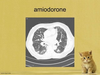 amiodorone
 