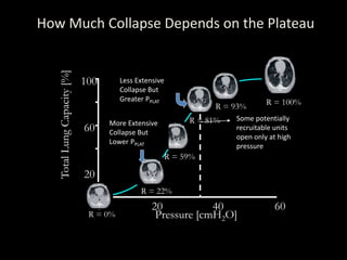 How Much Collapse Depends on the Plateau
R = 100%
20
60
100
Pressure [cmH2O]
20 40 60
TotalLungCapacity[%]
R = 22%
R = 81%
R = 93%
0
0
R = 0%
R = 59%
Some potentially
recruitable units
open only at high
pressure
More Extensive
Collapse But
Lower PPLAT
Less Extensive
Collapse But
Greater PPLAT
 