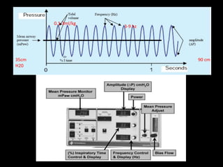 35cm
H20
90 cm
3-9 hz
0.1-3ml/kg
 