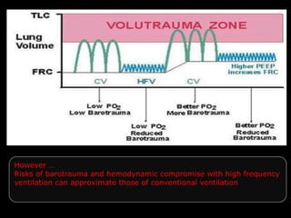 However …
Risks of barotrauma and hemodynamic compromise with high frequency
ventilation can approximate those of conventional ventilation
 