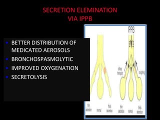 SECRETION ELEMINATION
VIA IPPB
• BETTER DISTRIBUTION OF
MEDICATED AEROSOLS
• BRONCHOSPASMOLYTIC
• IMPROVED OXYGENATION
• SECRETOLYSIS
 