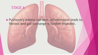 ACUTE RESPIRATORY DISTRESS SYNDROME PPTS | PPTX