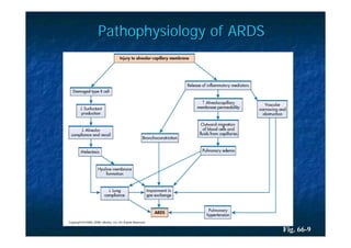 Pathophysiology of ARDS




                          Fig. 66-9
 