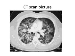CT scan picture
 