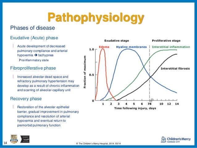 ARDS: The Old and the New (-ish)