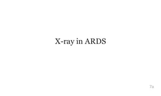 X-ray in ARDS
7a
 