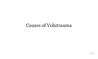 Causes of Volutrauma
17a
 