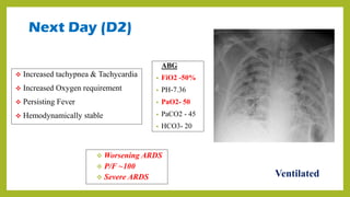 Next Day (D2)
 Worsening ARDS
 P/F ~100
 Severe ARDS
 Increased tachypnea & Tachycardia
 Increased Oxygen requirement
 Persisting Fever
 Hemodynamically stable
ABG
• FiO2 -50%
• PH-7.36
• PaO2- 50
• PaCO2 - 45
• HCO3- 20
Ventilated
 