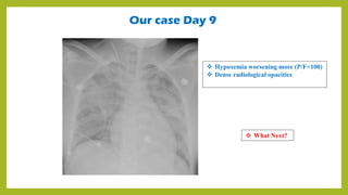Our case Day 9
 Hypoxemia worsening more (P/F<100)
 Dense radiological opacities
 What Next?
 