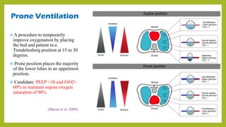 Prone Ventilation
 A procedure to temporarily
improve oxygenation by placing
the bed and patient in a
Trendelenberg position at 15 to 30
degrees.
 Prone position places the majority
of the lower lobes in an uppermost
position.
 Candidate: PEEP >10 and FIO2>
60% to maintain supine oxygen
saturation of 90%
(Marini et al. 2004).
 