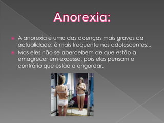 A anorexia é uma das doenças mais graves da actualidade, é mais frequente nos adolescentes...Mas eles não se apercebem de que estão a emagrecer em excesso, pois eles pensam o contrário que estão a engordar.Anorexia: