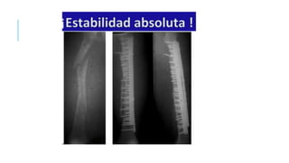 AREA DE TRABAJO.pptx