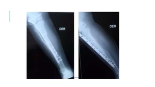 AREA DE TRABAJO.pptx