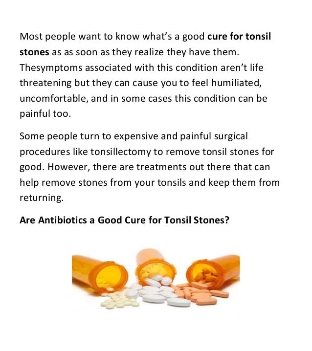Are antibiotics a good cure for tonsil stones