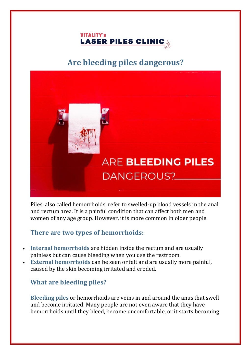 Are Bleeding Piles Dangerous? Bleeding Piles Treatment