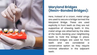 Are Dental Bridges a Solution for Missing Front Teeth - Elite Dental.pptx
