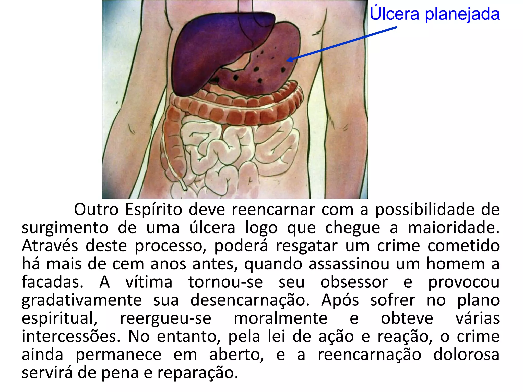 A reencarnacao de segismundo | PPTX