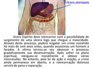 Úlcera planejada
Outro Espírito deve reencarnar com a possibilidade de
surgimento de uma úlcera logo que chegue a maioridade.
Através deste processo, poderá resgatar um crime cometido
há mais de cem anos antes, quando assassinou um homem a
facadas. A vítima tornou-se seu obsessor e provocou
gradativamente sua desencarnação. Após sofrer no plano
espiritual, reergueu-se moralmente e obteve várias
intercessões. No entanto, pela lei de ação e reação, o crime
ainda permanece em aberto, e a reencarnação dolorosa
servirá de pena e reparação.
 