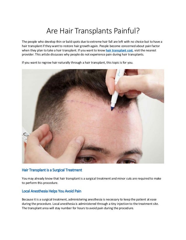 Are Hair Transplants Painful