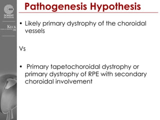 Pathogenesis Hypothesis Likely primary dystrophy of the choroidal vessels Vs Primary tapetochoroidal dystrophy or primary dystrophy of RPE with secondary choroidal involvement 