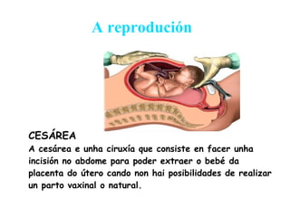A reprodución CESÁREA A cesárea e unha ciruxía que consiste en facer unha incisión no abdome para poder extraer o bebé da placenta do útero cando non hai posibilidades de realizar un parto vaxinal o natural. 