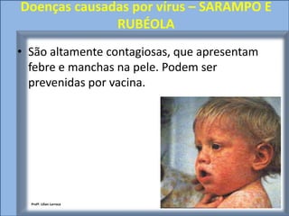 Doenças causadas por vírus – SARAMPO E
              RUBÉOLA
• São altamente contagiosas, que apresentam
  febre e manchas na pele. Podem ser
  prevenidas por vacina.




  Profª. Lilian Larroca
 