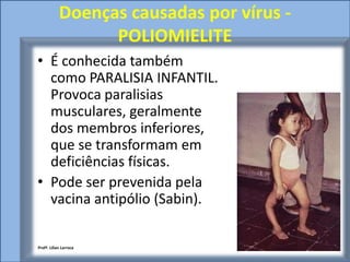 Doenças causadas por vírus -
                  POLIOMIELITE
• É conhecida também
  como PARALISIA INFANTIL.
  Provoca paralisias
  musculares, geralmente
  dos membros inferiores,
  que se transformam em
  deficiências físicas.
• Pode ser prevenida pela
  vacina antipólio (Sabin).

Profª. Lilian Larroca
 