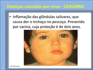 Doenças causadas por vírus - CAXUMBA

 • Inflamação das glândulas salivares, que
   causa dor e inchaço no pescoço. Prevenida
   por vacina, cuja proteção é de dois anos.




 Profª. Lilian Larroca
 
