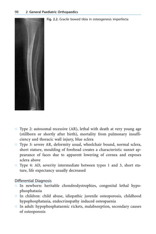 n Type 2: autosomal recessive (AR), lethal with death at very young age
(stillborn or shortly after birth), mortality from pulmonary insuffi-
ciency and thoracic wall injury, blue sclera
n Type 3: severe AR, deformity usual, wheelchair bound, normal sclera,
short stature, moulding of forehead creates a characteristic sunset ap-
pearance of faces due to apparent lowering of cornea and exposes
sclera above
n Type 4: AD, severity intermediate between types 1 and 3, short sta-
ture, life expectancy usually decreased
Differential Diagnosis
n In newborn: heritable chondrodystrophies, congenital lethal hypo-
phosphatasia
n In children: child abuse, idiopathic juvenile osteoporosis, childhood
hypophosphatasia, endocrinopathy induced osteopaenia
n In adult: hypophosphataemic rickets, malabsorption, secondary causes
of osteoporosis
98 2 General Paediatric Orthopaedics
Fig. 2.2. Gracile bowed tibia in osteogenesis imperfecta
 