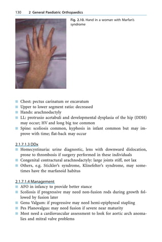 n Chest: pectus carinatum or excavatum
n Upper to lower segment ratio: decreased
n Hands: arachnodactyly
n LL: protrusio acetabuli and developmental dysplasia of the hip (DDH)
may occur; HV and long big toe common
n Spine: scoliosis common, kyphosis in infant common but may im-
prove with time; flat-back may occur
2.1.7.1.3 DDx
n Homecystinuria: urine diagnostic, lens with downward dislocation,
prone to thrombosis if surgery performed in these individuals
n Congenital contractural arachnodactyly: large joints stiff, not lax
n Others, e.g. Stickler's syndrome, Klinefelter's syndrome, may some-
times have the marfanoid habitus
2.1.7.1.4 Management
n AFO in infancy to provide better stance
n Scoliosis if progressive may need non-fusion rods during growth fol-
lowed by fusion later
n Genu Valgum: if progressive may need hemi-epiphyseal stapling
n Pes Planovalgus: may need fusion if severe near maturity
n Most need a cardiovascular assessment to look for aortic arch anoma-
lies and mitral valve problems
130 2 General Paediatric Orthopaedics
Fig. 2.10. Hand in a woman with Marfan's
syndrome
 