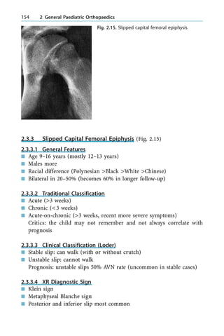 2.3.3 Slipped Capital Femoral Epiphysis (Fig. 2.15)
2.3.3.1 General Features
n Age 9±16 years (mostly 12±13 years)
n Males more
n Racial difference (Polynesian >Black >White >Chinese)
n Bilateral in 20±50% (becomes 60% in longer follow-up)
2.3.3.2 Traditional Classification
n Acute (>3 weeks)
n Chronic (<3 weeks)
n Acute-on-chronic (>3 weeks, recent more severe symptoms)
Critics: the child may not remember and not always correlate with
prognosis
2.3.3.3 Clinical Classification (Loder)
n Stable slip: can walk (with or without crutch)
n Unstable slip: cannot walk
Prognosis: unstable slips 50% AVN rate (uncommon in stable cases)
2.3.3.4 XR Diagnostic Sign
n Klein sign
n Metaphyseal Blanche sign
n Posterior and inferior slip most common
154 2 General Paediatric Orthopaedics
Fig. 2.15. Slipped capital femoral epiphysis
 