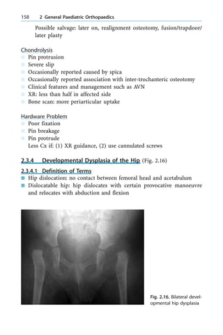 Possible salvage: later on, realignment osteotomy, fusion/trapdoor/
later plasty
Chondrolysis
n Pin protrusion
n Severe slip
n Occasionally reported caused by spica
n Occasionally reported association with inter-trochanteric osteotomy
n Clinical features and management such as AVN
n XR: less than half in affected side
n Bone scan: more periarticular uptake
Hardware Problem
n Poor fixation
n Pin breakage
n Pin protrude
Less Cx if: (1) XR guidance, (2) use cannulated screws
2.3.4 Developmental Dysplasia of the Hip (Fig. 2.16)
2.3.4.1 Definition of Terms
n Hip dislocation: no contact between femoral head and acetabulum
n Dislocatable hip: hip dislocates with certain provocative manoeuvre
and relocates with abduction and flexion
158 2 General Paediatric Orthopaedics
Fig. 2.16. Bilateral devel-
opmental hip dysplasia
 