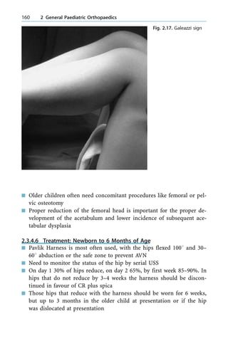 n Older children often need concomitant procedures like femoral or pel-
vic osteotomy
n Proper reduction of the femoral head is important for the proper de-
velopment of the acetabulum and lower incidence of subsequent ace-
tabular dysplasia
2.3.4.6 Treatment: Newborn to 6 Months of Age
n Pavlik Harness is most often used, with the hips flexed 1008 and 30±
608 abduction or the safe zone to prevent AVN
n Need to monitor the status of the hip by serial USS
n On day 1 30% of hips reduce, on day 2 65%, by first week 85±90%. In
hips that do not reduce by 3±4 weeks the harness should be discon-
tinued in favour of CR plus spica
n Those hips that reduce with the harness should be worn for 6 weeks,
but up to 3 months in the older child at presentation or if the hip
was dislocated at presentation
160 2 General Paediatric Orthopaedics
Fig. 2.17. Galeazzi sign
 