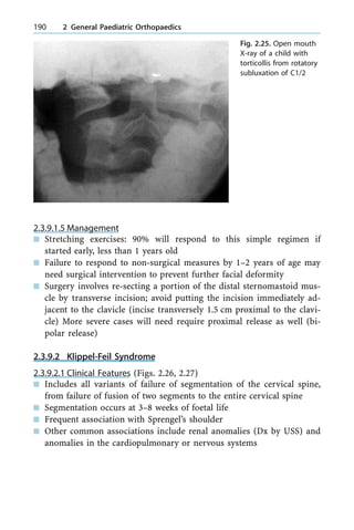 2.3.9.1.5 Management
n Stretching exercises: 90% will respond to this simple regimen if
started early, less than 1 years old
n Failure to respond to non-surgical measures by 1±2 years of age may
need surgical intervention to prevent further facial deformity
n Surgery involves re-secting a portion of the distal sternomastoid mus-
cle by transverse incision; avoid putting the incision immediately ad-
jacent to the clavicle (incise transversely 1.5 cm proximal to the clavi-
cle) More severe cases will need require proximal release as well (bi-
polar release)
2.3.9.2 Klippel-Feil Syndrome
2.3.9.2.1 Clinical Features (Figs. 2.26, 2.27)
n Includes all variants of failure of segmentation of the cervical spine,
from failure of fusion of two segments to the entire cervical spine
n Segmentation occurs at 3±8 weeks of foetal life
n Frequent association with Sprengel's shoulder
n Other common associations include renal anomalies (Dx by USS) and
anomalies in the cardiopulmonary or nervous systems
190 2 General Paediatric Orthopaedics
Fig. 2.25. Open mouth
X-ray of a child with
torticollis from rotatory
subluxation of C1/2
 