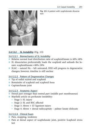 3.4.12.2 SL Instability (Fig. 3.9)
3.4.12.2.1 Biomechanics of SL Instability
n Relative normal load distribution ratio of scaphoid:lunate is 60%:40%
n SL dissociation preferentially loads the scaphoid and unloads the lu-
nate: scaphoid:lunate=80%:20%
n SLAC ± natural Hx ± left untreated, DISI will progress to degenerative
changes; however, timeline is still unclear
3.4.12.2.2 Pattern of Degenerative Changes
n Tip of radial styloid and scaphoid
n Remainder of scaphoid and scaphoid fossa
n Capitate/lunate joint
3.4.12.2.3 Anatomic Aspect
n Dorsal part stronger than ventral part (middle part membranous)
n Mayfield article on perilunate instability:
± Stage 1: SL injury
± Stage 2: SL and RSC affected
± Stage 3: Above + LT ligament injury
± Stage 4: Above + dorsal radiocapitate ± palmer lunate dislocate
3.4.12.2.4 Clinical Exam
n Pain, snapping, weakness
n Pain at dorsal aspect of scapholunate joint, positive Scaphoid stress
test
a 3.4 Carpal Instability 241
Fig. 3.9. A patient with scapholunate dissocia-
tion
 