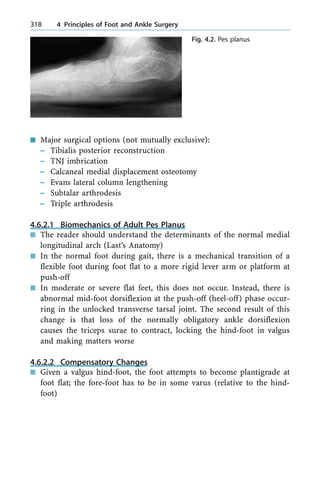 n Major surgical options (not mutually exclusive):
± Tibialis posterior reconstruction
± TNJ imbrication
± Calcaneal medial displacement osteotomy
± Evans lateral column lengthening
± Subtalar arthrodesis
± Triple arthrodesis
4.6.2.1 Biomechanics of Adult Pes Planus
n The reader should understand the determinants of the normal medial
longitudinal arch (Last's Anatomy)
n In the normal foot during gait, there is a mechanical transition of a
flexible foot during foot flat to a more rigid lever arm or platform at
push-off
n In moderate or severe flat feet, this does not occur. Instead, there is
abnormal mid-foot dorsiflexion at the push-off (heel-off) phase occur-
ring in the unlocked transverse tarsal joint. The second result of this
change is that loss of the normally obligatory ankle dorsiflexion
causes the triceps surae to contract, locking the hind-foot in valgus
and making matters worse
4.6.2.2 Compensatory Changes
n Given a valgus hind-foot, the foot attempts to become plantigrade at
foot flat; the fore-foot has to be in some varus (relative to the hind-
foot)
318 4 Principles of Foot and Ankle Surgery
Fig. 4.2. Pes planus
 