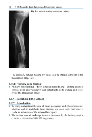 [By contrast, natural healing by callus can be strong, although often
malaligned. (Fig. 1.3)]
1.1.6.8 `Primary Bone Healing'
n Primary bone healing ± direct osteonal remodelling ± cutting cones at
cortical bone and vascularity and osteoblasts at its trailing end to re-
create the Harversian model
1.1.7 Metabolic Bone Disease
1.1.7.1 Introduction
n To really understand the role of bone in calcium and phosphorus me-
tabolism and in metabolic bone disease, one must note that bone is
really an extension of the extracellular space
n The surface area of exchange is much increased by the hydroxyapatite
crystals ± dimension 200´100 angstroms
16 1 Orthopaedic Basic Science and Commmon Injuries
Fig. 1.3. Natural healing by external calluses
 