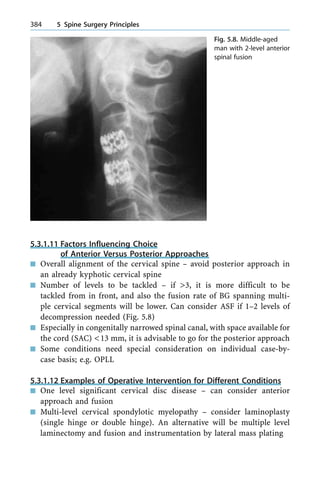 5.3.1.11 Factors Influencing Choice
of Anterior Versus Posterior Approaches
n Overall alignment of the cervical spine ± avoid posterior approach in
an already kyphotic cervical spine
n Number of levels to be tackled ± if >3, it is more difficult to be
tackled from in front, and also the fusion rate of BG spanning multi-
ple cervical segments will be lower. Can consider ASF if 1±2 levels of
decompression needed (Fig. 5.8)
n Especially in congenitally narrowed spinal canal, with space available for
the cord (SAC) <13 mm, it is advisable to go for the posterior approach
n Some conditions need special consideration on individual case-by-
case basis; e.g. OPLL
5.3.1.12 Examples of Operative Intervention for Different Conditions
n One level significant cervical disc disease ± can consider anterior
approach and fusion
n Multi-level cervical spondylotic myelopathy ± consider laminoplasty
(single hinge or double hinge). An alternative will be multiple level
laminectomy and fusion and instrumentation by lateral mass plating
384 5 Spine Surgery Principles
Fig. 5.8. Middle-aged
man with 2-level anterior
spinal fusion
 