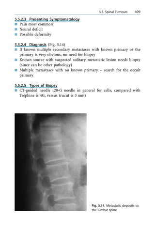 5.5.2.3 Presenting Symptomatology
n Pain most common
n Neural deficit
n Possible deformity
5.5.2.4 Diagnosis (Fig. 5.14)
n If known multiple secondary metastases with known primary or the
primary is very obvious, no need for biopsy
n Known source with suspected solitary metastatic lesion needs biopsy
(since can be other pathology)
n Multiple metastases with no known primary ± search for the occult
primary
5.5.2.5 Types of Biopsy
n CT-guided needle (20-G needle in general for cells, compared with
Trephine is 4G, versus trucut is 3 mm)
a 5.5 Spinal Tumours 409
Fig. 5.14. Metastatic deposits to
the lumbar spine
 