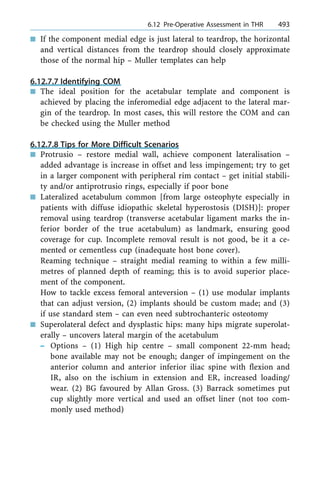 n If the component medial edge is just lateral to teardrop, the horizontal
and vertical distances from the teardrop should closely approximate
those of the normal hip ± Muller templates can help
6.12.7.7 Identifying COM
n The ideal position for the acetabular template and component is
achieved by placing the inferomedial edge adjacent to the lateral mar-
gin of the teardrop. In most cases, this will restore the COM and can
be checked using the Muller method
6.12.7.8 Tips for More Difficult Scenarios
n Protrusio ± restore medial wall, achieve component lateralisation ±
added advantage is increase in offset and less impingement; try to get
in a larger component with peripheral rim contact ± get initial stabili-
ty and/or antiprotrusio rings, especially if poor bone
n Lateralized acetabulum common [from large osteophyte especially in
patients with diffuse idiopathic skeletal hyperostosis (DISH)]: proper
removal using teardrop (transverse acetabular ligament marks the in-
ferior border of the true acetabulum) as landmark, ensuring good
coverage for cup. Incomplete removal result is not good, be it a ce-
mented or cementless cup (inadequate host bone cover).
Reaming technique ± straight medial reaming to within a few milli-
metres of planned depth of reaming; this is to avoid superior place-
ment of the component.
How to tackle excess femoral anteversion ± (1) use modular implants
that can adjust version, (2) implants should be custom made; and (3)
if use standard stem ± can even need subtrochanteric osteotomy
n Superolateral defect and dysplastic hips: many hips migrate superolat-
erally ± uncovers lateral margin of the acetabulum
± Options ± (1) High hip centre ± small component 22-mm head;
bone available may not be enough; danger of impingement on the
anterior column and anterior inferior iliac spine with flexion and
IR, also on the ischium in extension and ER, increased loading/
wear. (2) BG favoured by Allan Gross. (3) Barrack sometimes put
cup slightly more vertical and used an offset liner (not too com-
monly used method)
a 6.12 Pre-Operative Assessment in THR 493
 